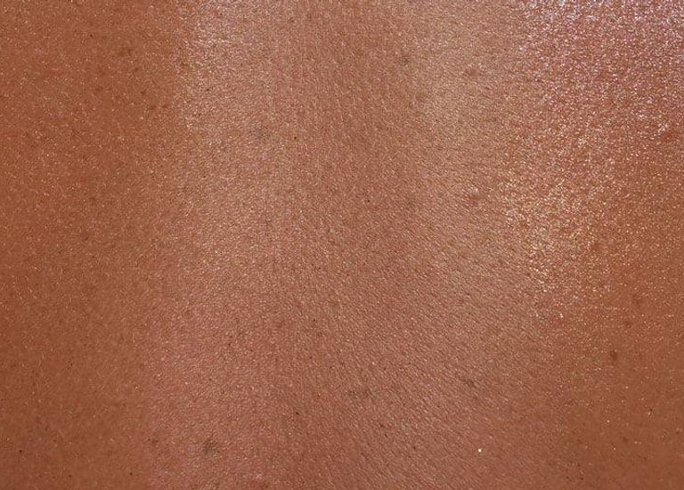 larocheposay articlepage allergic skin allergy sensitive skin and reactive skin