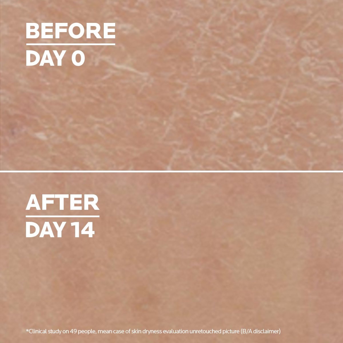lrp_lipikarlait_urea10__beforeandafter_va_dmi_square250x250_na_no-cta_1200x1200px